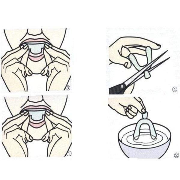 pares-de-protectores-bucales-para-dorm_main-3